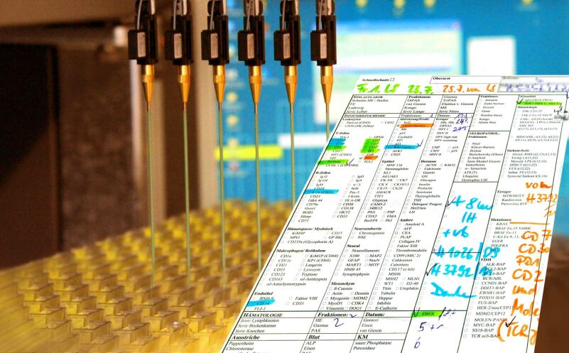 Unverzichtbar für die lymphompathologische Referenzdiagnostik sind immunhistochemische Färbungen, die entspr. den Einträgen auf einem Anforderungsformular mittels Laborautomaten durchgeführt werden.