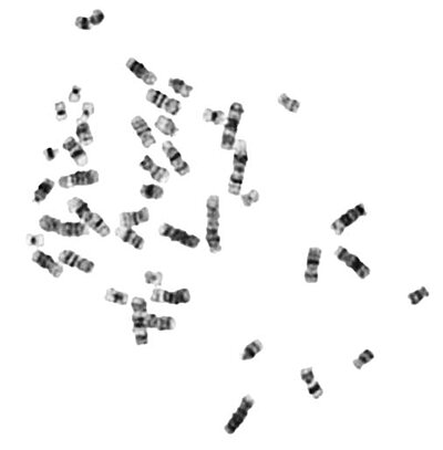 Metaphasenpräparat (hier originär, unten sortiert