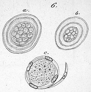 Illustration aus dem "Archiv für pathologische Anatomie und Physiologie und für klinische Medizin", herausgegeben von R. Virchow und B. Reinhardt, 3. Band, Berlin, 1851
