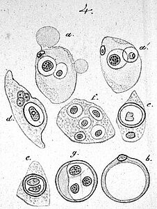 Illustration aus dem "Archiv für pathologische Anatomie und Physiologie und für klinische Medizin", herausgegeben von R. Virchow und B. Reinhardt, 3. Band, Berlin, 1851